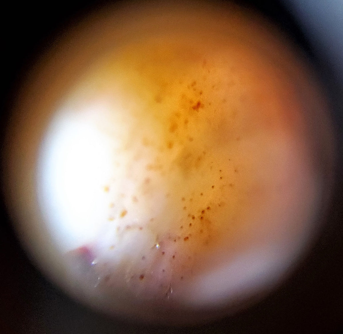 Macro close-up of Tasso dzi bloodspot zone showing dense cinnabar bloodspot micro-dots on orange agate, At-052526-TaBS