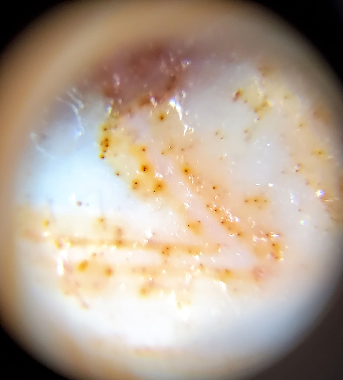 Ancient Tasso Dzi bead closeup showing mahogany-purple agate, amber patterning, and scattered cinnabar bloodspots on weathered surface
