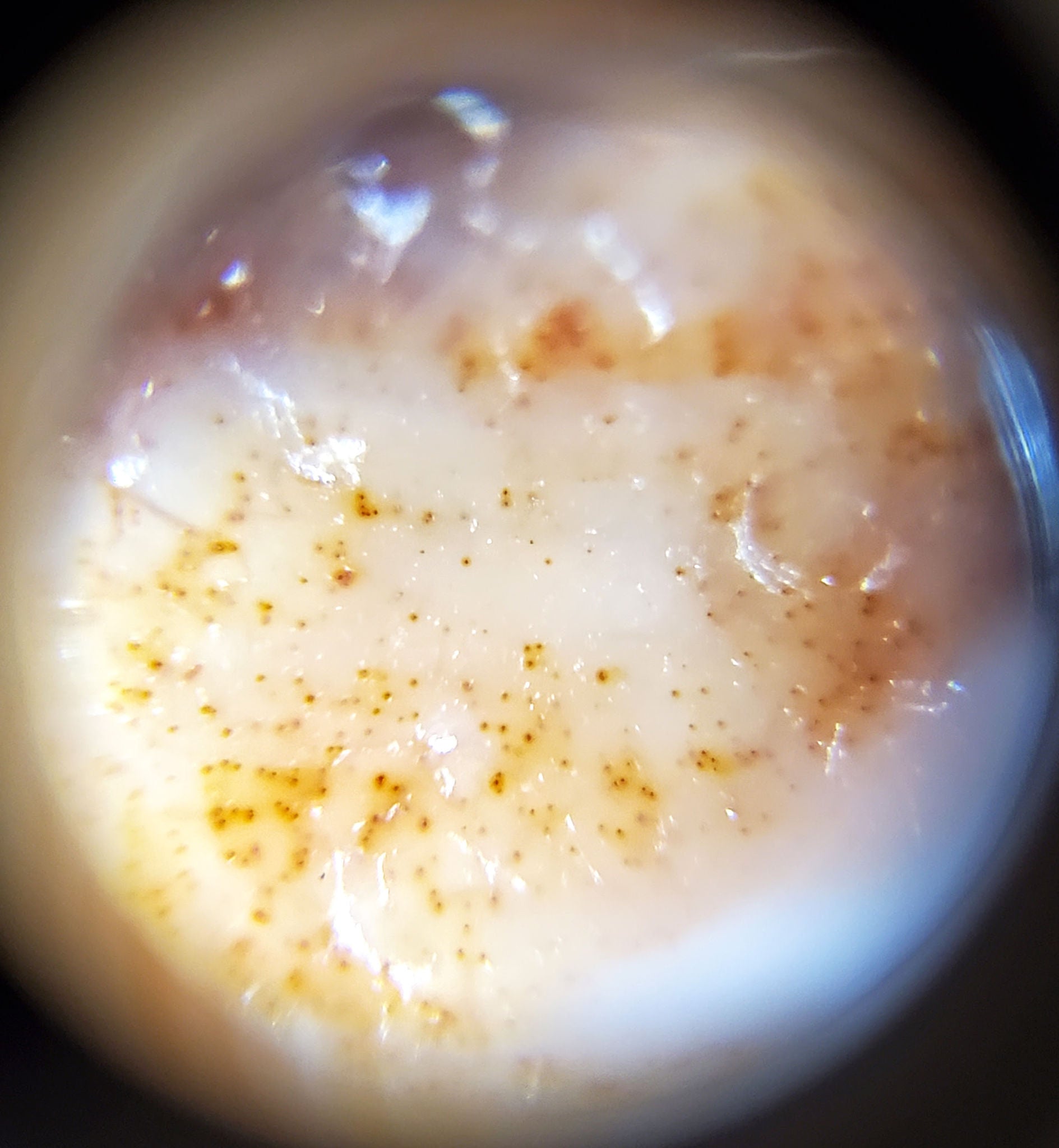 Second microscope view of cinnabar bloodspots — dense amber-gold scatter in cream agate zone